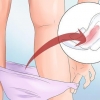 Prevención del sangrado vaginal durante el embarazo