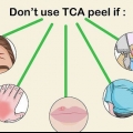 Aplicar un peeling tca