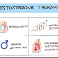 Dar una inyección de testosterona