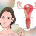 Diagnóstico de flujo vaginal