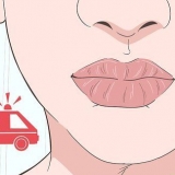 Cura una quemadura en tus labios