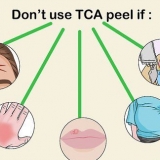 Aplicar un peeling tca