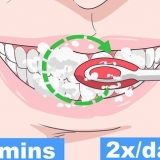 Evitar que una caries en los dientes empeore