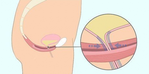 Hacer ejercicios de kegel