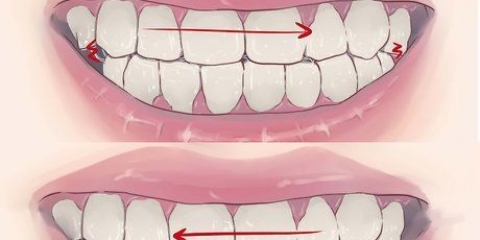 Deja de rechinar los dientes mientras duermes