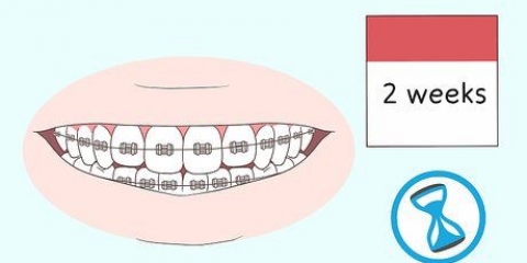 Besandose con brackets