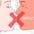 Prevención de un herpes labial